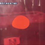 世界初 IPS細胞の再生医療が実用化へ01.transfer_frame_209.jpeg